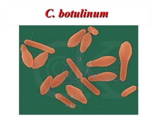 C. botulinumC. botulinum
 