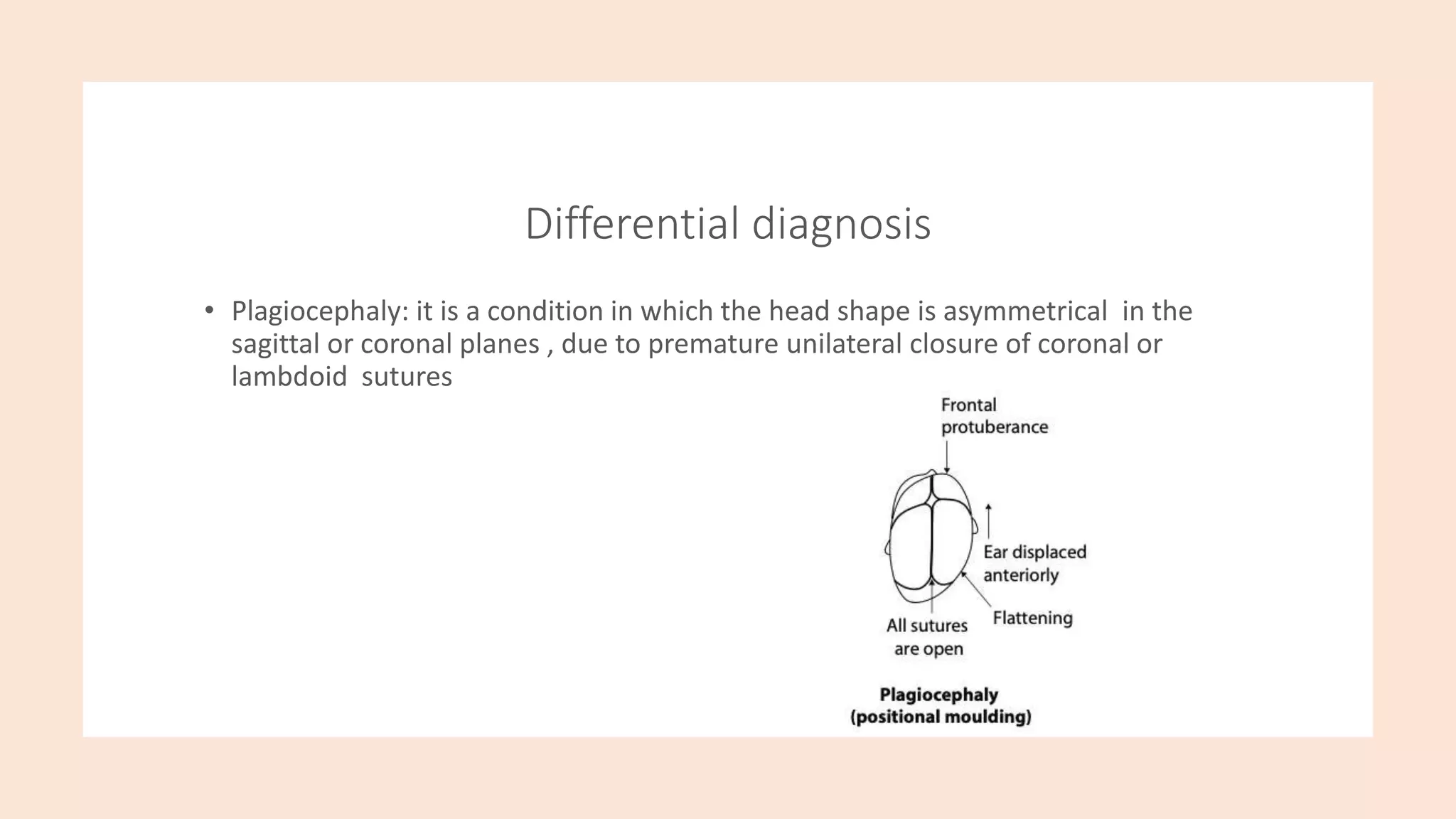 Differential diagnosis
• Plagiocephaly: it is a condition in which the head shape is asymmetrical in the
sagittal or coronal planes , due to premature unilateral closure of coronal or
lambdoid sutures
 