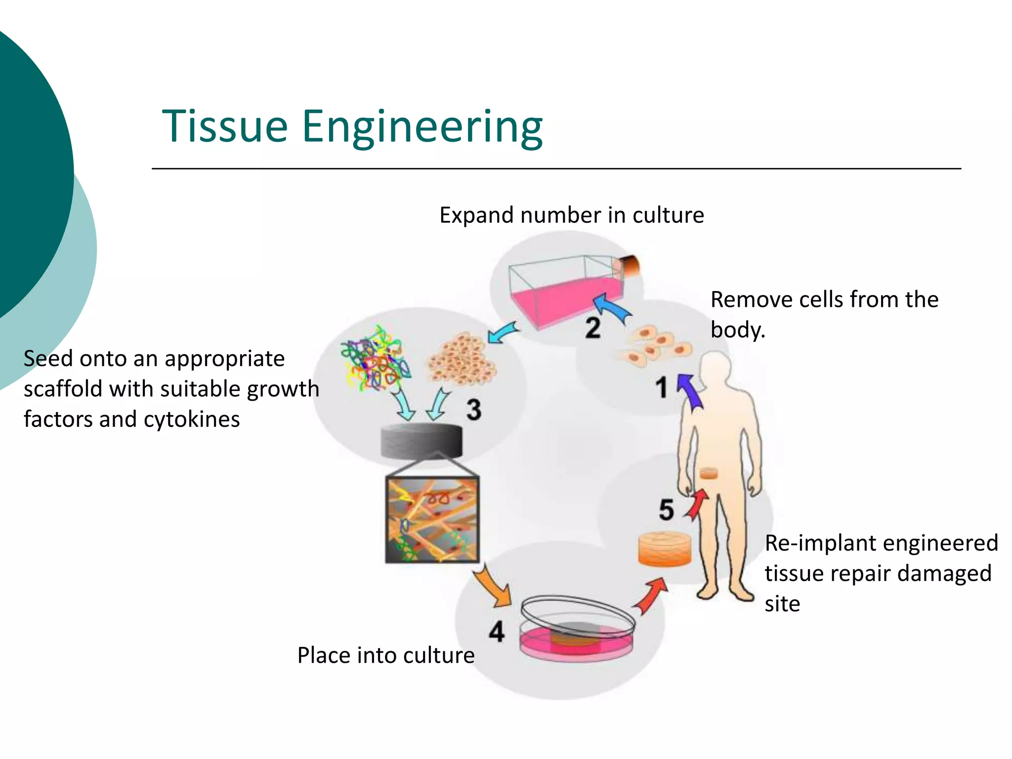 Tissue Engineering
Expand number in culture
Remove cells from the
body.
Seed onto an appropriate
scaffold with suitable growth
factors and cytokines

Re-implant engineered
tissue repair damaged
site
Place into culture

 