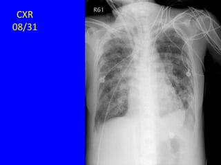 CXR
08/31
 