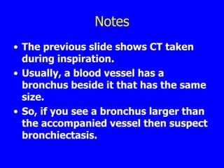 Notes
• The previous slide shows CT taken
  during inspiration.
• Usually, a blood vessel has a
  bronchus beside it that has the same
  size.
• So, if you see a bronchus larger than
  the accompanied vessel then suspect
  bronchiectasis.
 