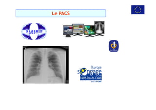 Le PACS
 