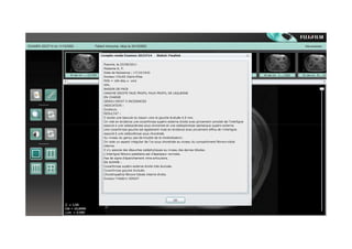 REX d'établissements ayant mis en oeuvre le zéro papier - Sylvie Delplanque, CH Nord Pas de Calais