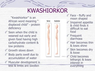 KWASHIORKOR     “ Kwashiorkor” is an African word meaning “ displaced child” - protein deficiency Seen when the child is weaned out early and given food having high carbohydrate content & low proteins Growth slows down Body parts swell due to accumulation of water Muscular development is less & limbs are swollen Face - fluffy and moon shaped Impaired appetite & child finds it difficult to eat food Frequent diarrhoea Hair becomes thin & loses shine Skin becomes dry & loose Child becomes lethargic & loses interest in everything 