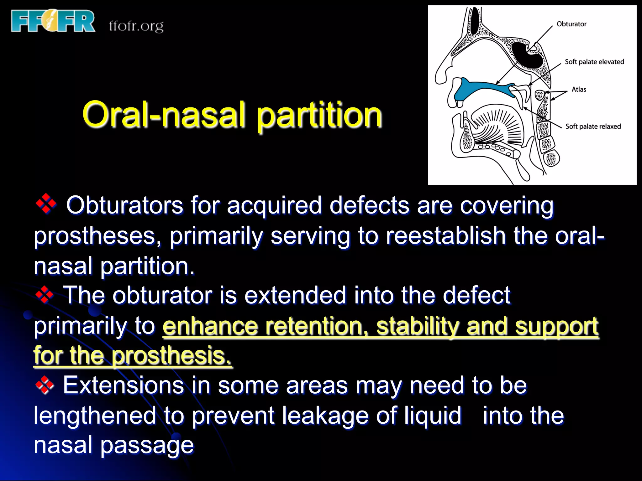 13. definitive obturation treatment concepts | PDF