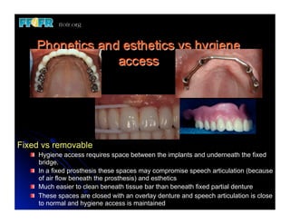 Overlay Temporary Denture 13.edent max overlay dentures | PDF