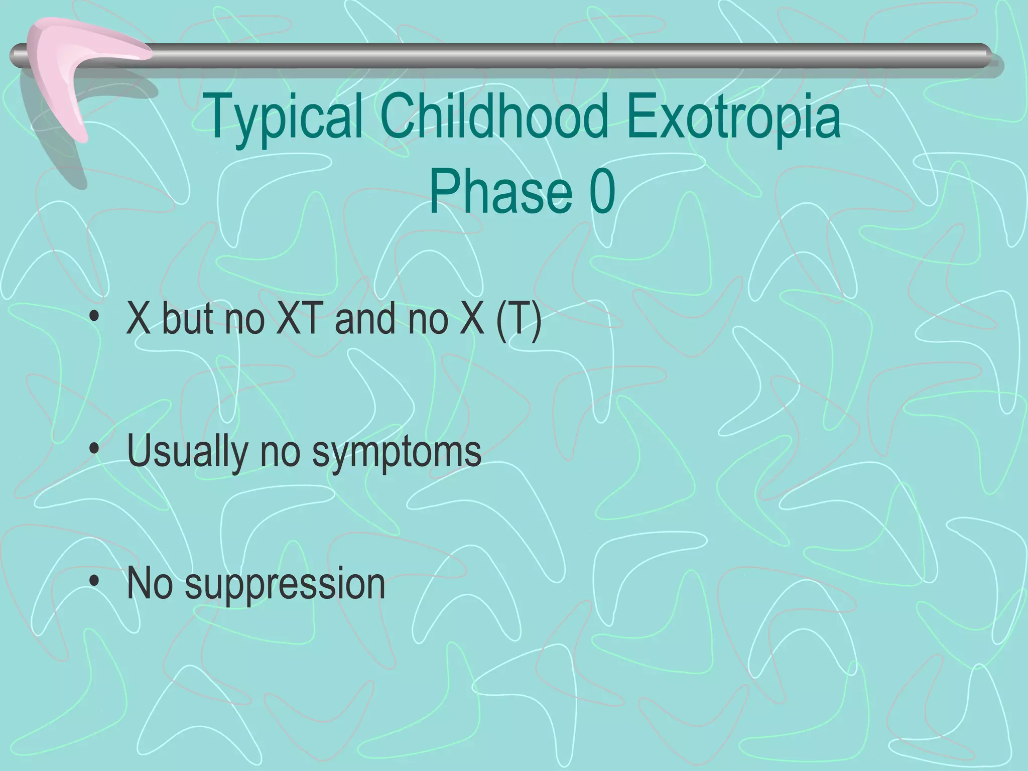 Typical Childhood Exotropia
Phase 0
• X but no XT and no X (T)
• Usually no symptoms
• No suppression
 