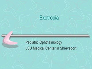 Exotropia
Pediatric Ophthalmology
LSU Medical Center in Shreveport
 