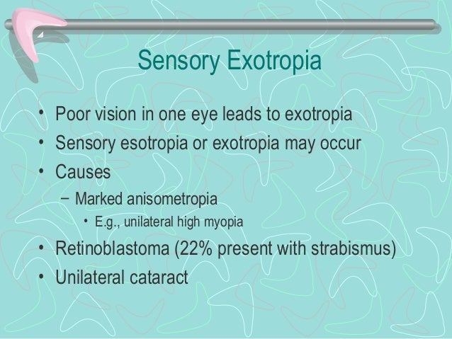 13 Exotropia