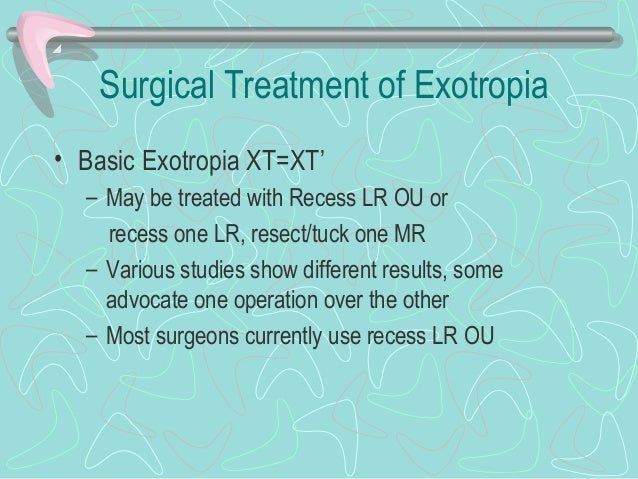 13 Exotropia 13 Exotropia