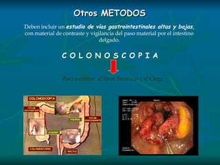 Otros METODOS Deben incluir un  estudio de vías gastrointestinales altas y bajas ,  con material de contraste y vigilancia del paso material por el intestino delgado. C O L O N O S C O P I A Para explorar  el ileon Terminal y el Ciego 