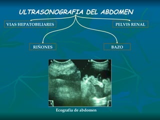 ULTRASONOGRAFIA DEL ABDOMEN VIAS HEPATOBILIARES BAZO PELVIS RENAL RIÑONES Ecografía de abdomen 