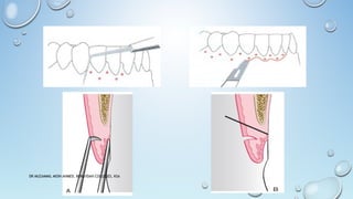 DR MUZAMMIL MOIN AHMED, BURAYDAH COLLEGES, KSA
 