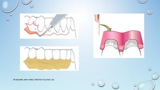 DR MUZAMMIL MOIN AHMED, BURAYDAH COLLEGES, KSA
 