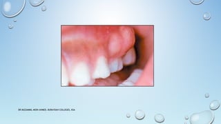 DR MUZAMMIL MOIN AHMED, BURAYDAH COLLEGES, KSA
 