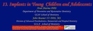 13. Implants in Young Children and Adolescents
                                                     Arun Sharma DDS
                         Department of Preventive and Restorative Dentistry
                                    UCSF School of Dentistry
                                             John Beumer III DDS, MS
            Division of Advanced Prosthodontics, Biomaterials and Hospital Dentistry
                                               UCLA School of Dentistry
     This program of instruction is protected by copyright ©. No portion of this program of instruction
     may be reproduced, recorded or transferred by any means electronic, digital, photographic,
     mechanical etc., or by any information storage or retrieval system, without prior permission.
 