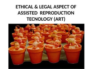 ETHICAL & LEGAL ASPECT OF
ASSISTED REPRODUCTION
TECNOLOGY (ART)
 