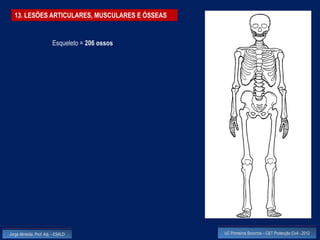 13. LESÕES ARTICULARES, MUSCULARES E ÓSSEAS


                         Esqueleto = 206 ossos




Jorge Almeida, Prof. Adj. - ESALD                UC Primeiros Socorros – CET Protecção Civil - 2012
 