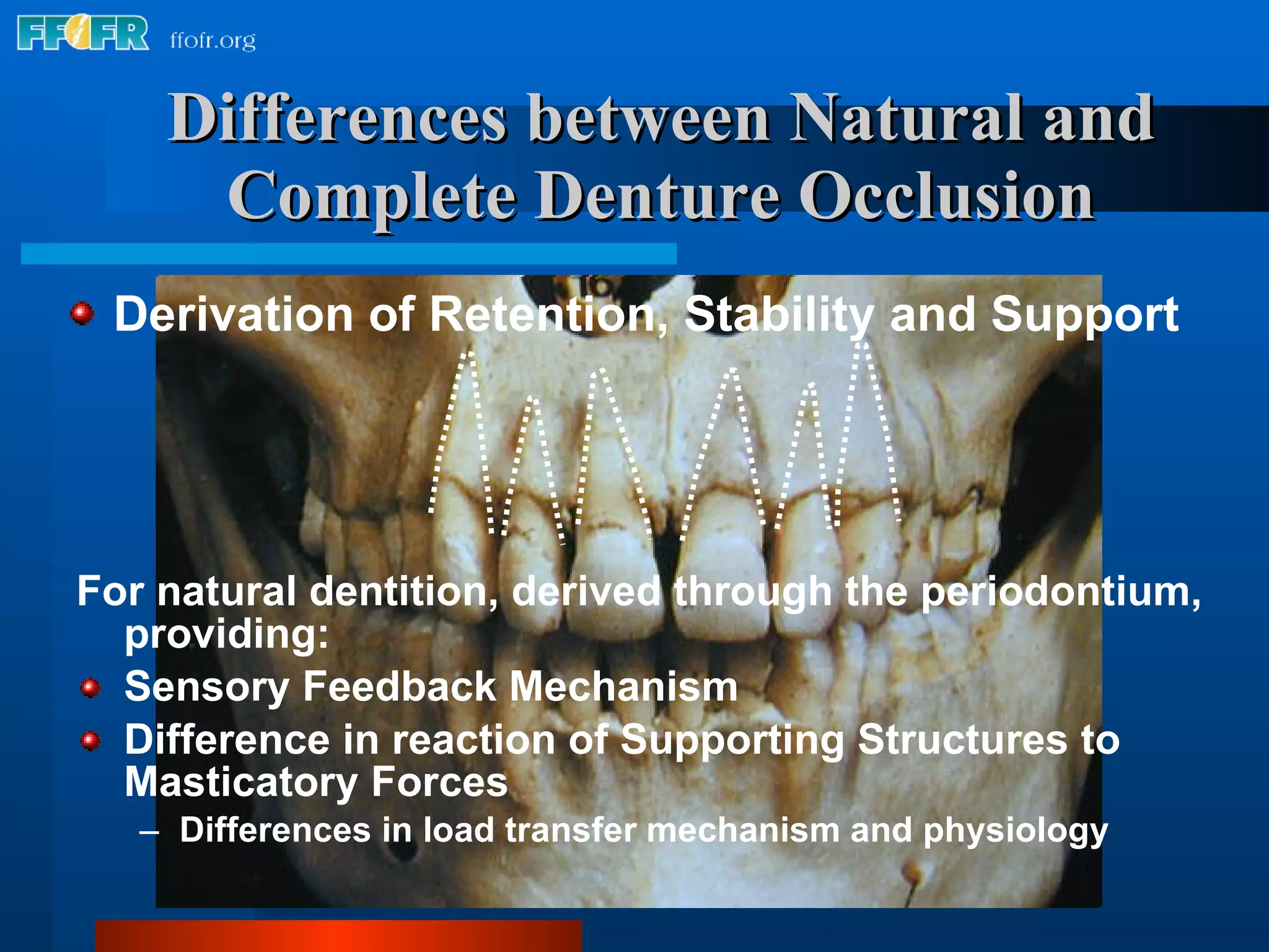 Differences between Natural and Complete Denture Occlusion For natural dentition, derived through the periodontium, providing: Sensory Feedback Mechanism Difference in reaction of Supporting Structures to Masticatory Forces Differences in load transfer mechanism and physiology Derivation of Retention, Stability and Support 