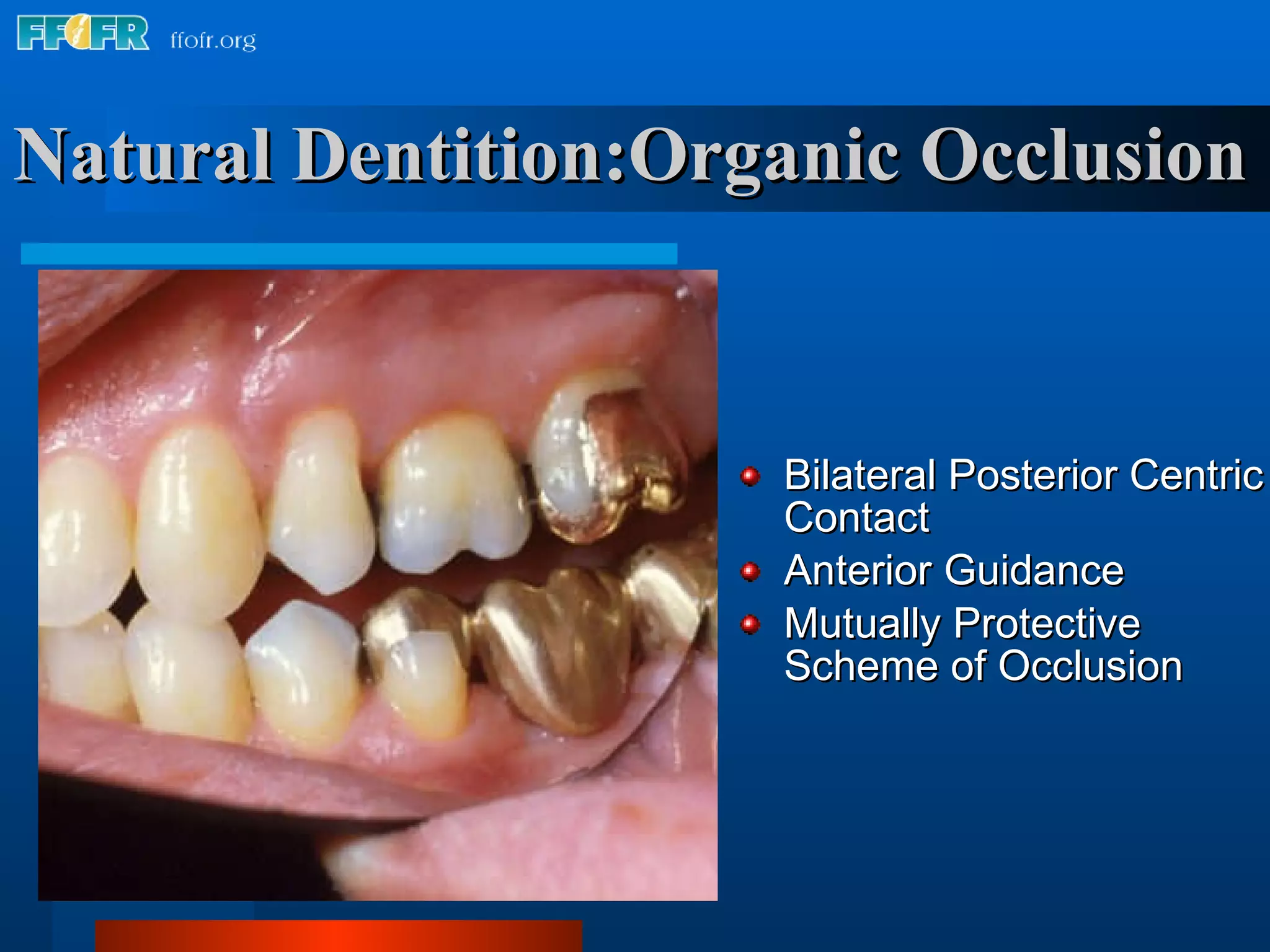 Natural Dentition:Organic Occlusion Bilateral Posterior Centric Contact Anterior Guidance Mutually Protective Scheme of Occlusion 