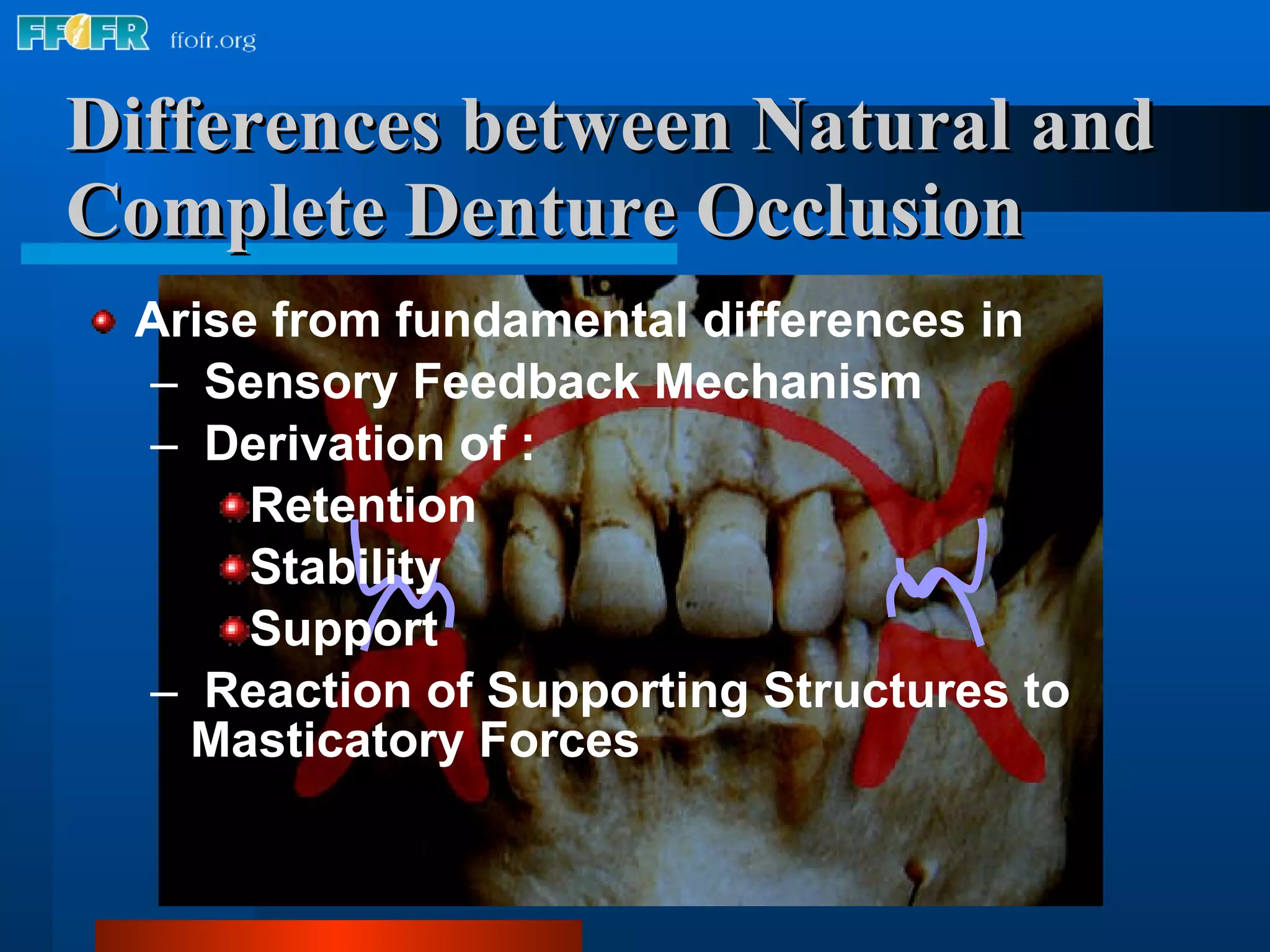 Differences between Natural and Complete Denture Occlusion Arise from fundamental differences in Sensory Feedback Mechanism Derivation of : Retention Stability Support Reaction of Supporting Structures to Masticatory Forces 