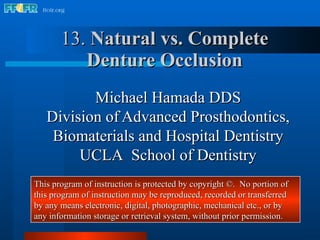 13.  Natural vs. Complete Denture Occlusion Michael Hamada DDS Division of   Advanced Prosthodontics, Biomaterials and Hospital Dentistry UCLA  School of Dentistry This program of instruction is protected by copyright ©.  No portion of this program of instruction may be reproduced, recorded or transferred by any means electronic, digital, photographic, mechanical etc., or by any information storage or retrieval system, without prior permission. 