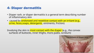 Comprehensive Overview of Neonatal Sepsis and Newborn Infections ...