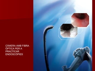 CÀMERA AMB FIBRA
ÒPTICA PER A
PRACTICAR
ENDOSCÒPIES
 