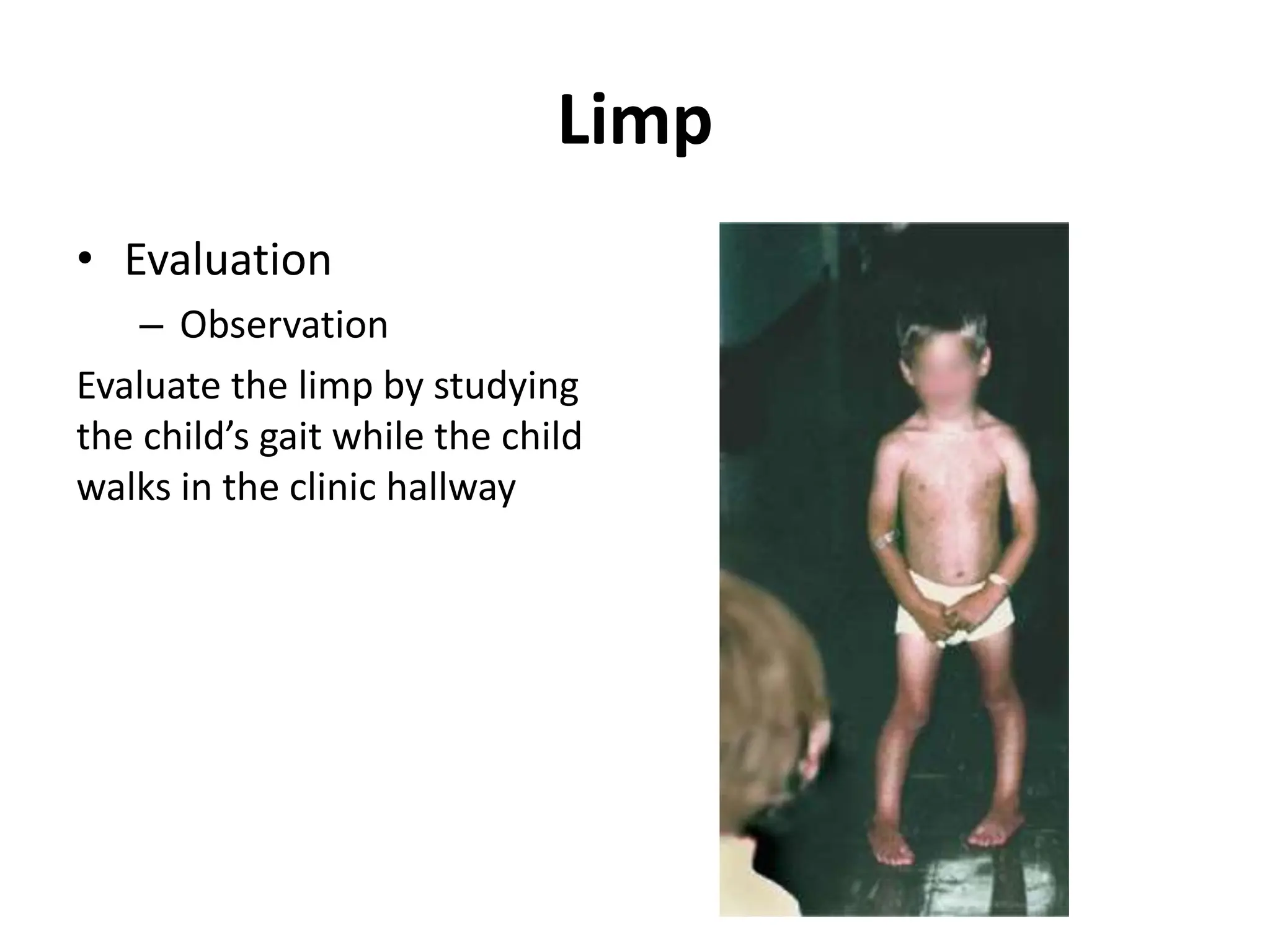 13-pediatric common lower limb disorders.ppt