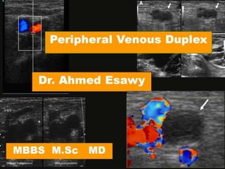 13 peripheral venous duplex ct mri in dvt dr ahmed esawy
