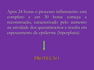 Após 24 horas o processo inflamatório está completo e em 30 horas começa a reconstrução, caracterizado pelo aumento na atividade dos queratinócitos e resulta em espessamento da epiderme (hiperplasia). PROTEÇÃO 
