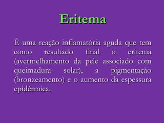 Eritema É uma reação inflamatória aguda que tem como resultado final o eritema (avermelhamento da pele associado com queimadura solar), a pigmentação (bronzeamento) e o aumento da espessura epidérmica. 