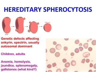 HEREDITARY SPHEROCYTOSIS 
Genetic defects affecting 
ankyrin, spectrin, usually 
autosomal dominant 
Children, adults 
Anemia, hemolysis, 
jaundice, splenomegaly, 
gallstones (what kind?) 
 