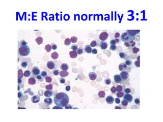M:E Ratio normally 3:1
 