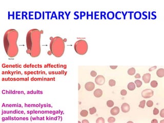 HEREDITARY SPHEROCYTOSIS
Genetic defects affecting
ankyrin, spectrin, usually
autosomal dominant
Children, adults
Anemia, hemolysis,
jaundice, splenomegaly,
gallstones (what kind?)
 