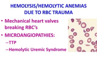 HEMOLYSIS/HEMOLYTIC ANEMIAS
DUE TO RBC TRAUMA
• Mechanical heart valves
breaking RBC’s
• MICROANGIOPATHIES:
–TTP
–Hemolytic Uremic Syndrome
 