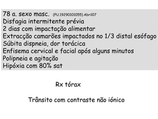 78 a. sexo masc. (PU.19290101055) Abril07
Disfagia intermitente prévia
2 dias com impactação alimentar
Extracção camarões impactados no 1/3 distal esófago
Súbita dispneia, dor torácica
Enfisema cervical e facial após alguns minutos
Polipneia e agitação
Hipóxia com 80% sat


                 Rx tórax

        Trânsito com contraste não iónico
 