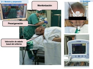 Z Intra Opera periodo intraoperario de la anestesiologia | PPTX