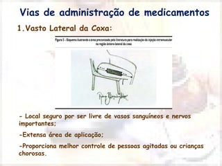 Vias de administração de medicamentos 
1.Vasto Lateral da Coxa: 
- Local seguro por ser livre de vasos sanguíneos e nervos 
importantes; 
-Extensa área de aplicação; 
-Proporciona melhor controle de pessoas agitadas ou crianças 
chorosas. 
 