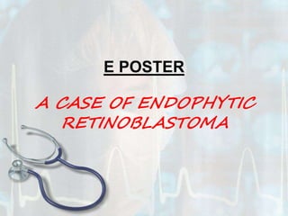 E POSTER
A CASE OF ENDOPHYTIC
RETINOBLASTOMA
 