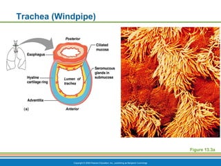Copyright © 2009 Pearson Education, Inc., publishing as Benjamin Cummings
Trachea (Windpipe)
Figure 13.3a
 