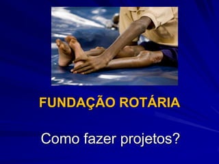 FUNDAÇÃO ROTÁRIA

Como fazer projetos?
 