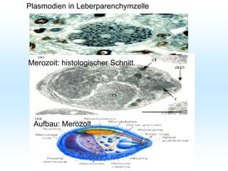 Plasmodien in Leberparenchymzelle
Merozoit: histologischer Schnitt.
Aufbau: Merozoit.
 