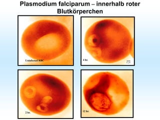 Plasmodium falciparum – innerhalb roter
Blutkörperchen
Uninfected RBC
2 hr.
4 hr.
12 hr.
 