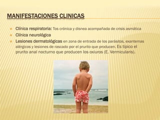 MANIFESTACIONES CLINICAS
Ò  Clínica respiratoria: Tos crónica y disnea acompañada de crisis asmática
Ò  Clínica neurológica
Ò  Lesiones dermatológicas en zona de entrada de los parásitos, exantemas
alérgicos y lesiones de rascado por el prurito que producen. Es típico el
prurito anal nocturno que producen los oxiuros (E. Vermicularis).
 