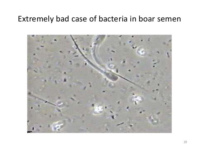 Dr. Don Levis - Reproductive Decision Tree