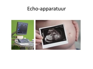 Echo-apparatuur

 