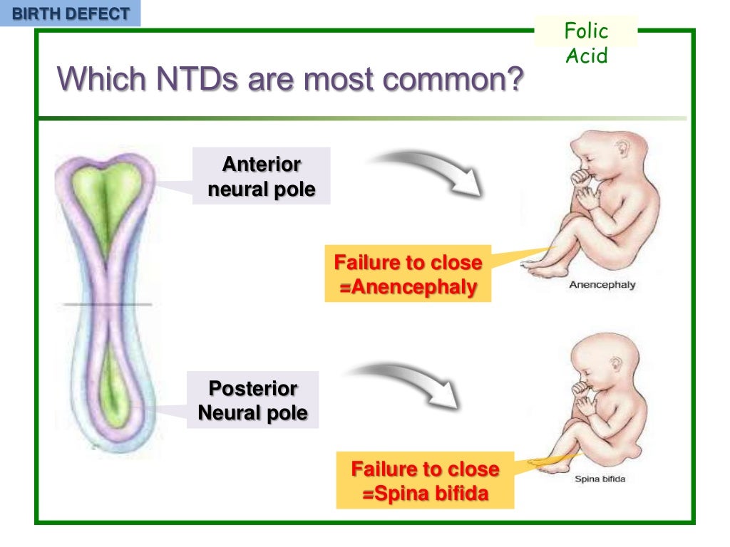 folic acid in pregnancy 이민영 전임의
