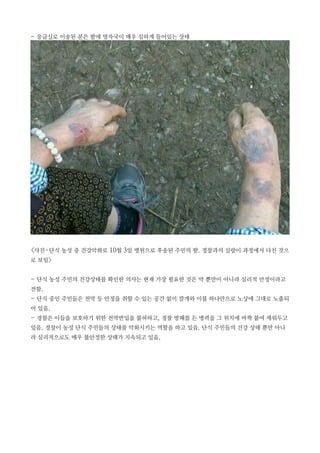 - 응급실로 이송된 분은 팔에 멍자국이 매우 심하게 들어있는 상태
<사진-단식 농성 중 건강악화로 10월 3일 병원으로 후송된 주민의 팔. 경찰과의 실랑이 과정에서 다친 것으
로 보임>
- 단식 농성 주민의 건강상태를 확인한 의사는 현재 가장 필요한 것은 약 뿐만이 아니라 심리적 안정이라고
전함.
- 단식 중인 주민들은 천막 등 안정을 취할 수 있는 공간 없이 깔개와 이불 하나만으로 노상에 그대로 노출되
어 있음.
- 경찰은 이들을 보호하기 위한 천막반입을 불허하고, 경찰 방패를 든 병력을 그 위치에 바짝 붙여 세워두고
있음. 경찰이 농성 단식 주민들의 상태를 악화시키는 역할을 하고 있음. 단식 주민들의 건강 상태 뿐만 아니
라 심리적으로도 매우 불안정한 상태가 지속되고 있음.
 