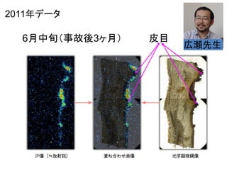 2011年データ

6月中旬（事故後3ヶ月）

皮目

広瀬先生

 